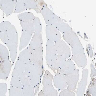 Immunohistochemistry-Paraffin: SEC23B Antibody [NBP1-85732]