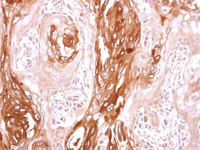 Immunohistochemistry-Paraffin: SEC23B Antibody [NBP2-20279]