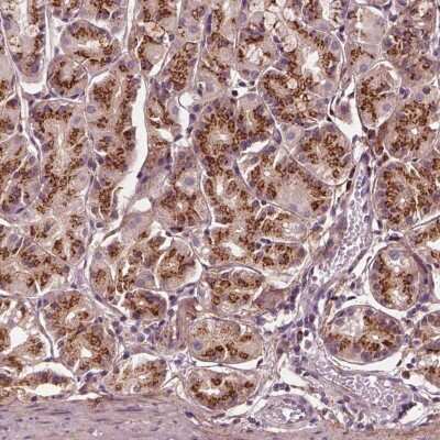 Immunohistochemistry-Paraffin: SEC23B Antibody [NBP2-56982]