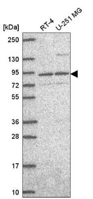 Western Blot: SEC23B Antibody [NBP2-56982]