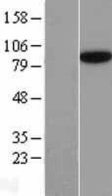 Western Blot: SEC23B Overexpression Lysate [NBL1-15778]