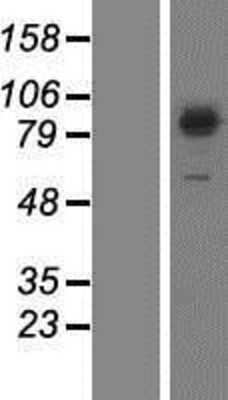 Western Blot: SEC23B Overexpression Lysate [NBP2-09830]