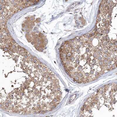 Immunohistochemistry-Paraffin: SEC23IP Antibody [NBP1-82456]