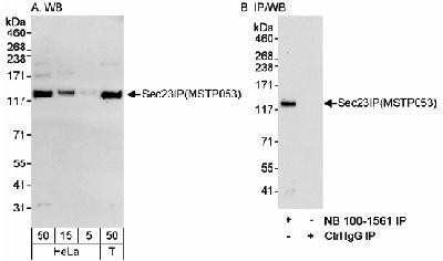 Western Blot: SEC23IP Antibody [NB100-1561]