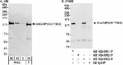 Western Blot: SEC23IP Antibody [NB100-1563]