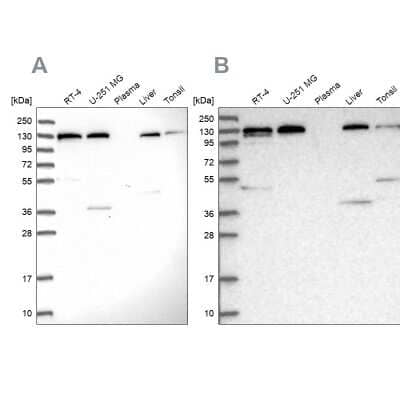 Western Blot: SEC23IP Antibody [NBP2-58361]