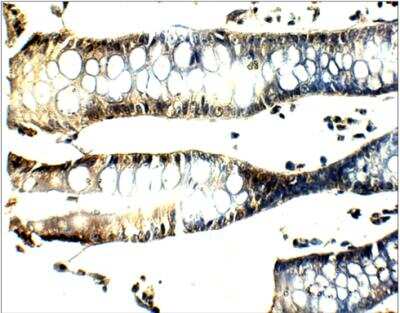 Immunohistochemistry-Paraffin: SEC24B Antibody [NBP3-12266]