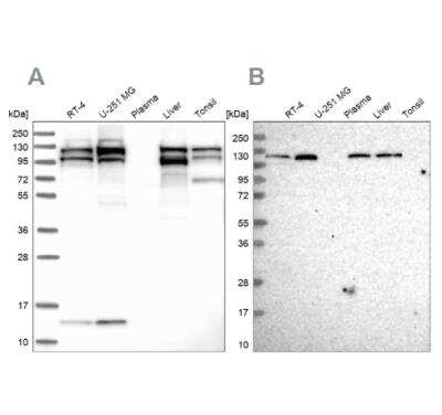 Western Blot: SEC24C Antibody [NBP1-81550]
