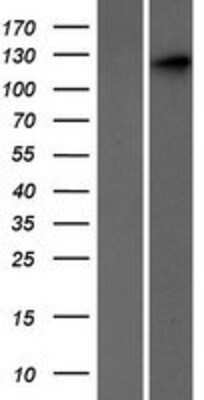 Western Blot: SEC24C Overexpression Lysate [NBP2-04677]