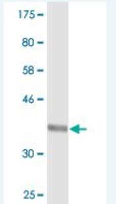 Western Blot: SEC24D Antibody (2D4) [H00009871-M03]