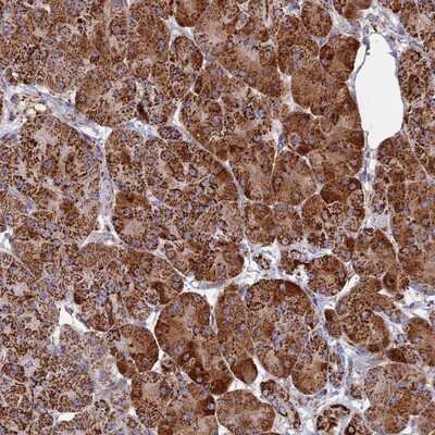 Immunohistochemistry-Paraffin: SEC24D Antibody [NBP1-81482]