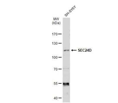 Western Blot: SEC24D Antibody [NBP2-20280]