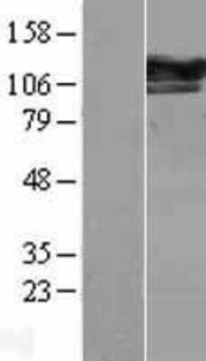 Western Blot: SEC24D Overexpression Lysate [NBL1-15783]