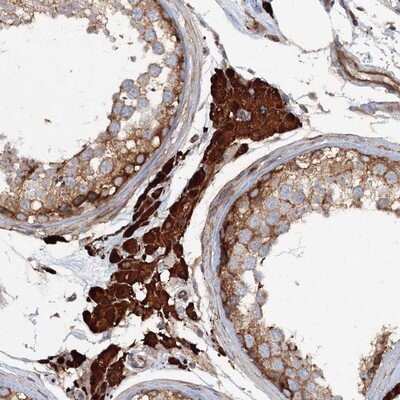 Immunohistochemistry-Paraffin: SEC3 Antibody [NBP1-89957]