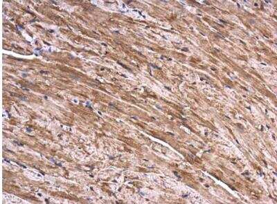 Immunohistochemistry-Paraffin: SEC3 Antibody [NBP2-20281]