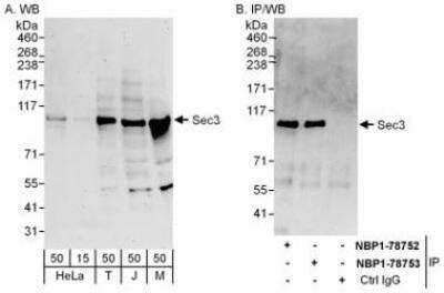 Immunoprecipitation: SEC3 Antibody [NBP1-78752]