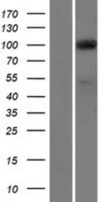 Western Blot: SEC3 Overexpression Lysate [NBP2-04978]