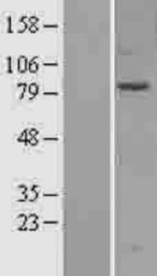 Western Blot: SEC3 Overexpression Lysate [NBP2-11037]