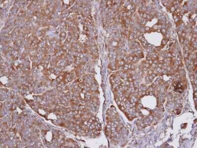 Immunohistochemistry-Paraffin: SEC31A Antibody [NBP1-31874]