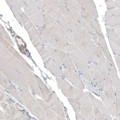 Immunohistochemistry-Paraffin: SEC31A Antibody [NBP1-89301]
