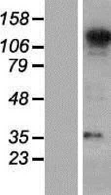 Western Blot: SEC31A Overexpression Lysate [NBP2-08450]