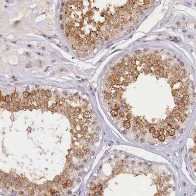 Immunohistochemistry-Paraffin: SEC31B Antibody [NBP1-85106]