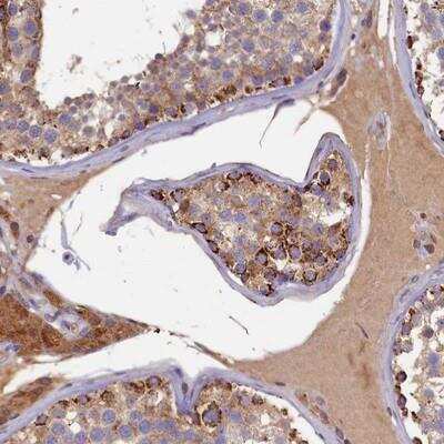 Immunohistochemistry-Paraffin: SEC31B Antibody [NBP1-85107]