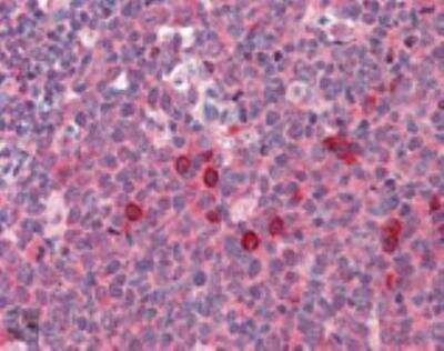 Immunohistochemistry-Paraffin: SEC6 Antibody (9H5) [NBP1-97500]