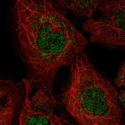 Immunocytochemistry/ Immunofluorescence: SEC6 Antibody [NBP2-55179]