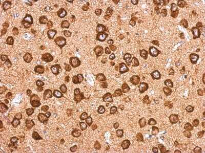 Immunohistochemistry-Paraffin: SEC6 Antibody [NBP2-20282]