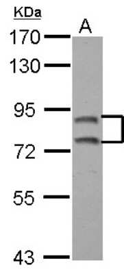 Western Blot: SEC6 Antibody [NBP2-20282]