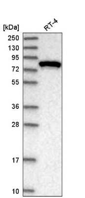 Western Blot: SEC6 Antibody [NBP2-55179]