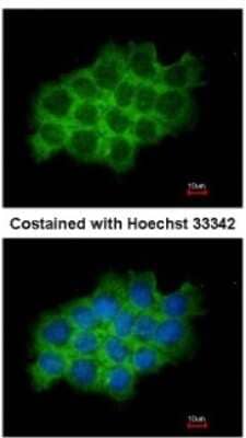 Immunocytochemistry/ Immunofluorescence: SEC61A Antibody [NBP1-31267]