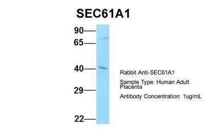 Western Blot: SEC61A Antibody [NBP2-86797]