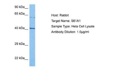 Western Blot: SEC61A Antibody [NBP2-86799]