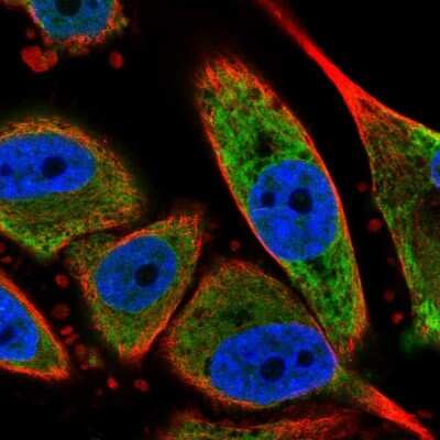 Immunocytochemistry/ Immunofluorescence: SEC61B Antibody [NBP2-13290]