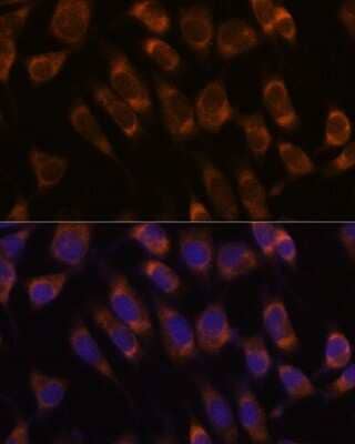 Immunocytochemistry/ Immunofluorescence: SEC61B Antibody - Azide and BSA Free [NBP2-93984]