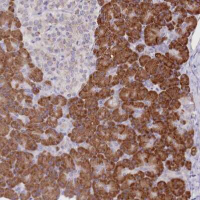 Immunohistochemistry-Paraffin: SEC61B Antibody [NBP2-13290]