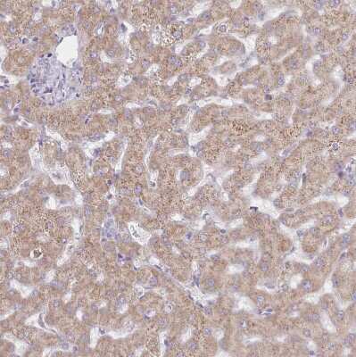 Immunohistochemistry-Paraffin: SEC61B Antibody [NBP2-13290]