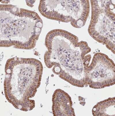 Immunohistochemistry-Paraffin: SEC61B Antibody [NBP2-13290]