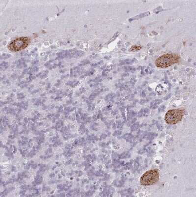 Immunohistochemistry-Paraffin: SEC61B Antibody [NBP2-13290]