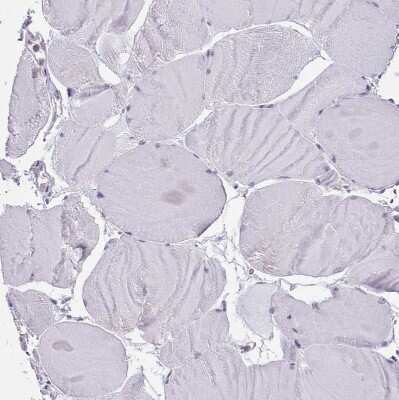 Immunohistochemistry-Paraffin: SEC61B Antibody [NBP2-13290]
