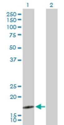 Western Blot: SEC61B Antibody [H00010952-D01P]