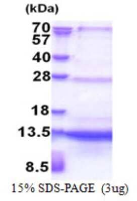 SDS-PAGE: Recombinant Human SEC61B His Protein [NBP2-23455]