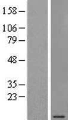 Western Blot: SEC61G Overexpression Lysate [NBL1-15786]