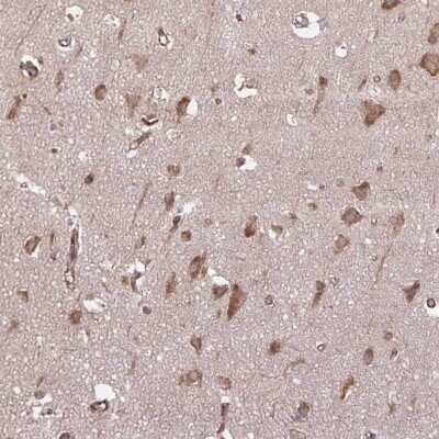 Immunohistochemistry: SEC62 Antibody [NBP2-38920]