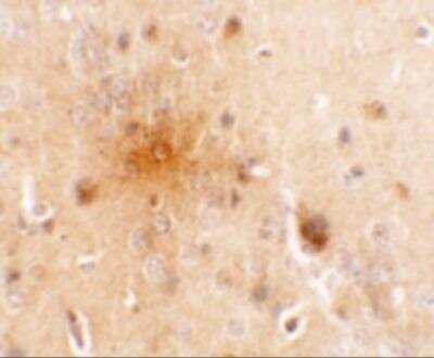 Immunohistochemistry: SEC62 Antibody - BSA Free [NBP2-81813]