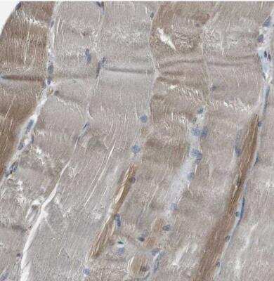 Immunohistochemistry-Paraffin: SEC62 Antibody [NBP1-84045]
