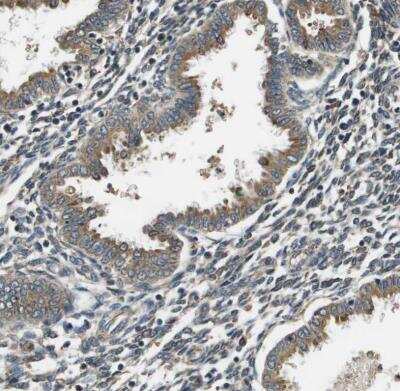 Immunohistochemistry-Paraffin: SEC62 Antibody [NBP1-84045]