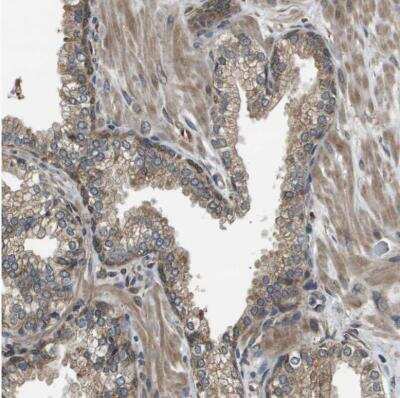 Immunohistochemistry-Paraffin: SEC62 Antibody [NBP1-84045]